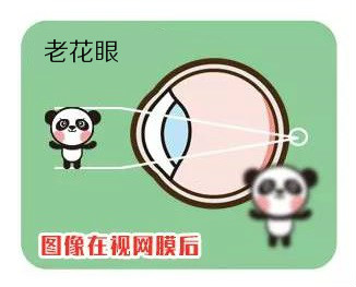 有了老花该怎么办？